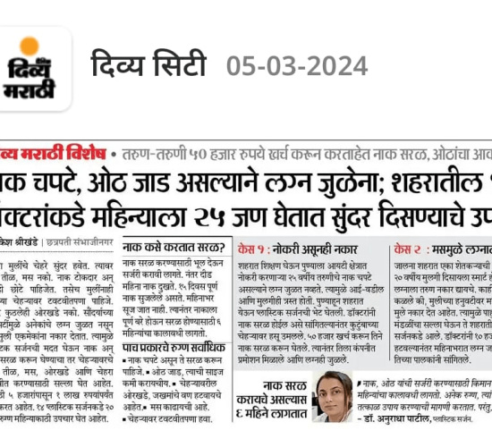 Dr. Anuradha Yadav, plastic surgeon, featured in Divya Marathi Newspaper.