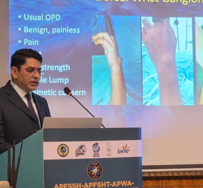 Dr Jayesh Yadav discussing dorsal wrist ganglion arthroscopic excision at Mumbai conference